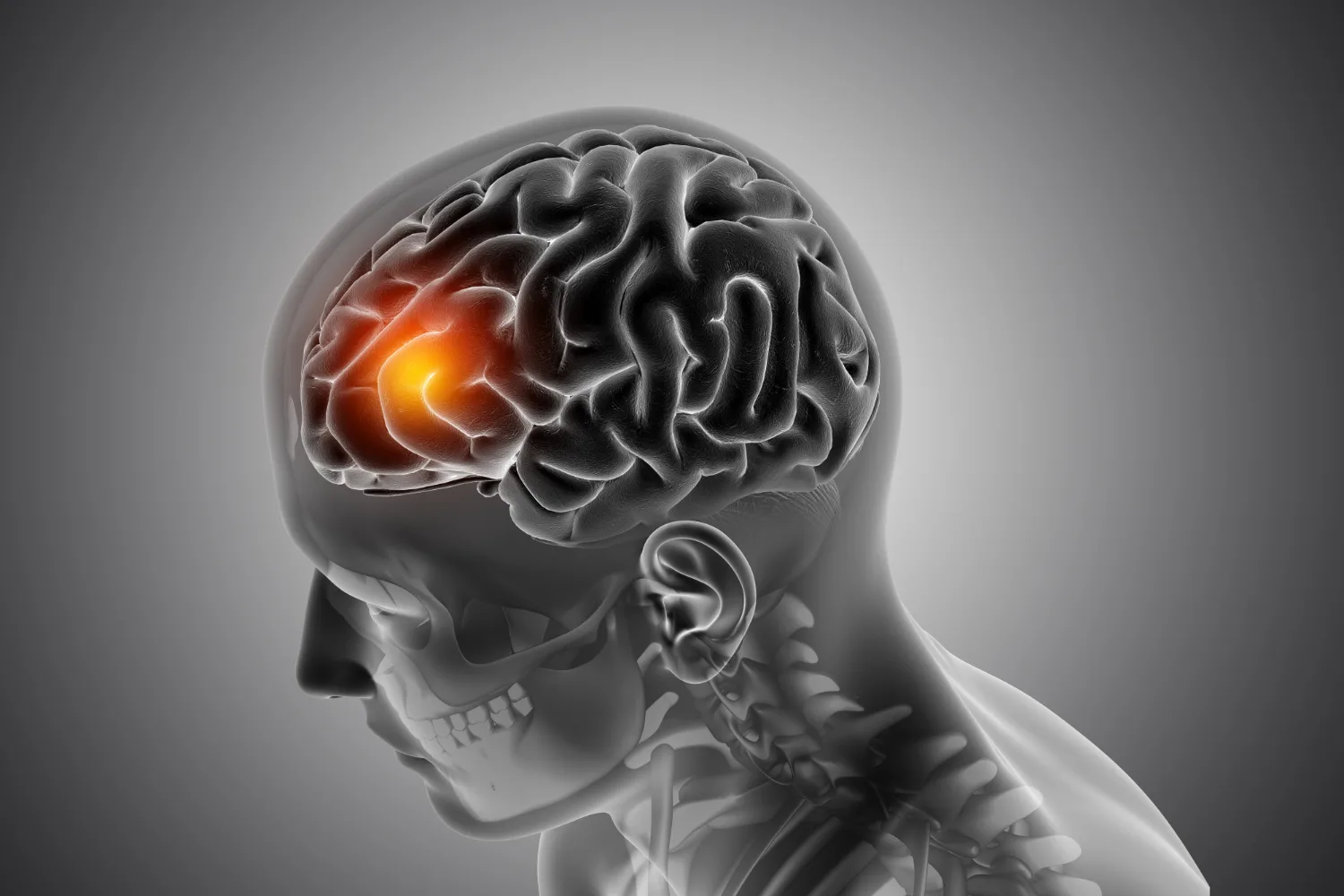 Consulta especializada en neurocirugía